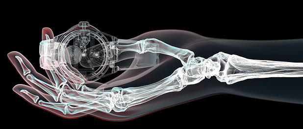 X-ray